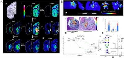 Advances in MALDI Mass Spectrometry Imaging Single Cell and Tissues